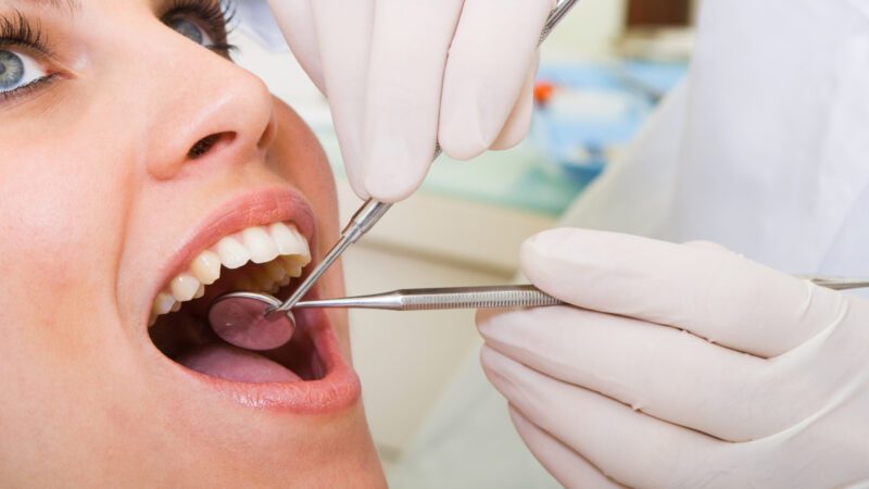 What You Should Know About Denture Care